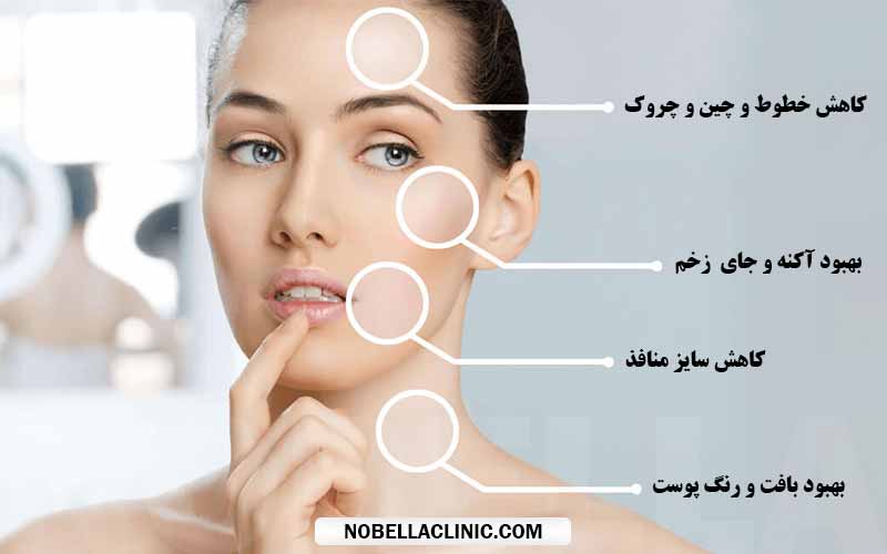 فواید مزوتراپی