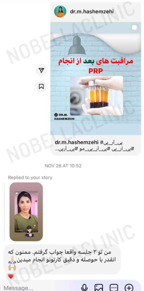 نظرات در مورد پی آر پی صورت