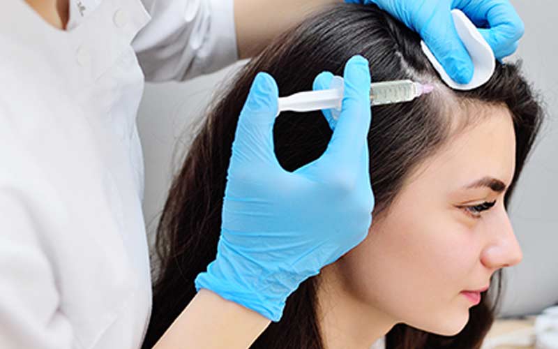 هزینه پی آر پی مو