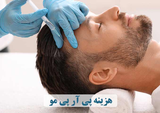 هزینه پی آر پی مو