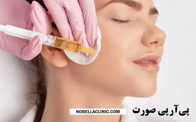 ماندگاری پی ار پی صورت چقدر است