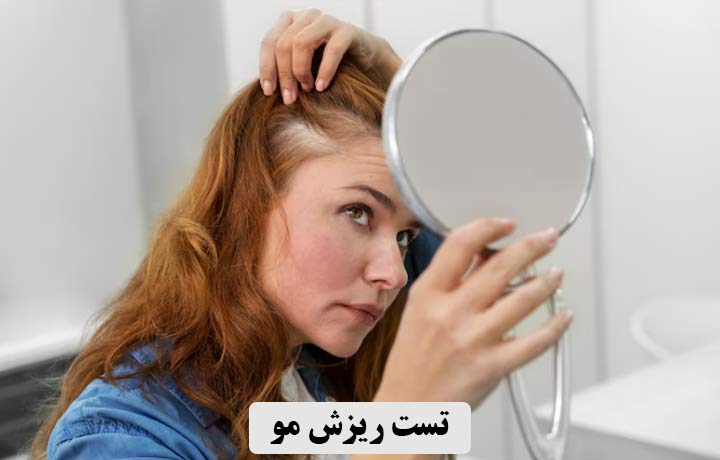 تست ریزش مو – تست ریزش مو آنلاین در خانه