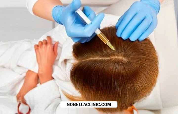 اگزوزوم تراپی مو بانوان