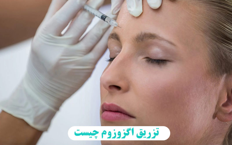 اگزوزوم چیست