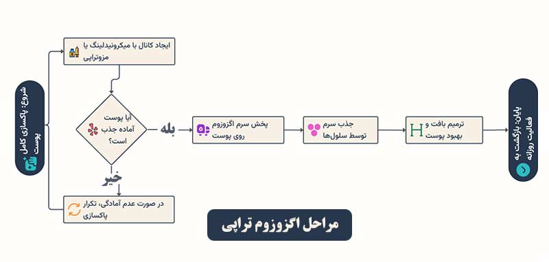 مراحل اگزوزوم تراپی