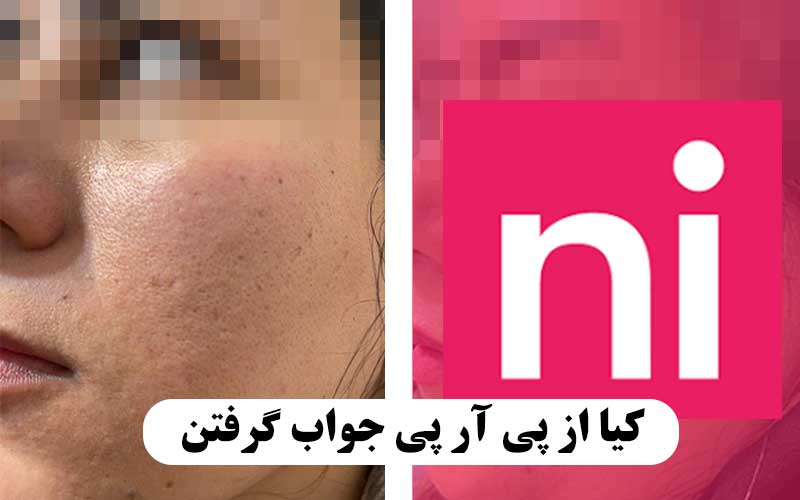كيا از پي ار پي جواب گرفتن نی نی سایت + تصاویر نظرات