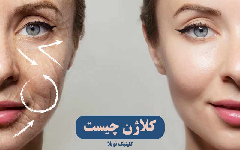 همه چیز درباره کلاژن ؛ فواید ، منابع و تاثیر پی آر پی بر کلاژن سازی