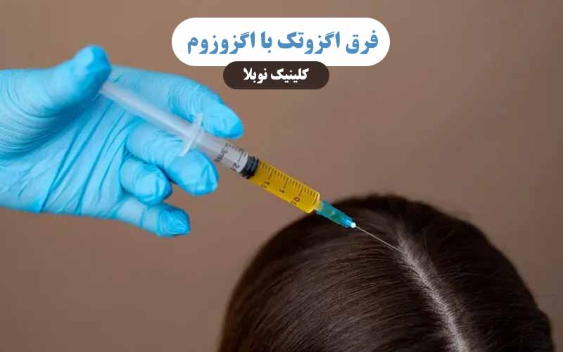 فرق اگزوتک با اگزوزوم