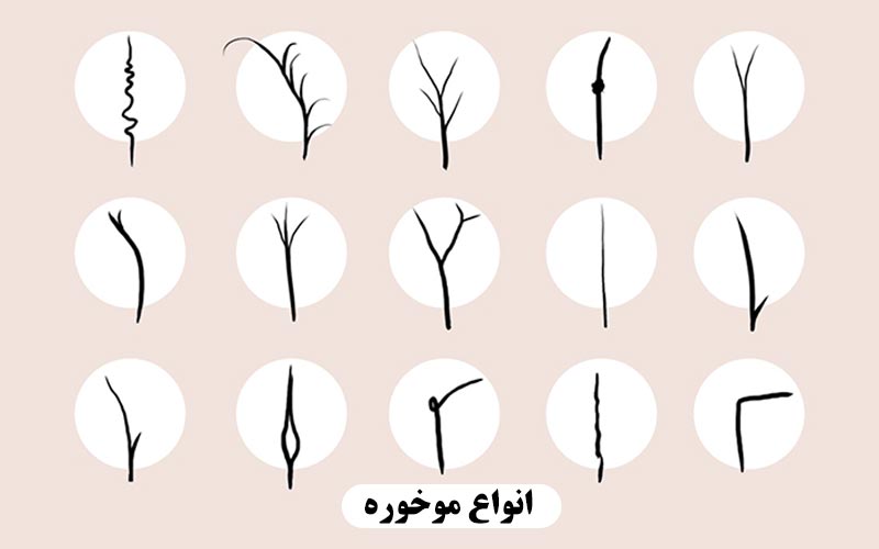 انواع موخوره