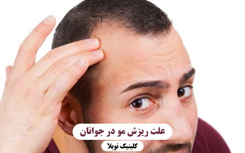 علت ریزش مو در جوانان چیست ؟ بررسی دلایل اصلی و راه‌ های کنترل آن