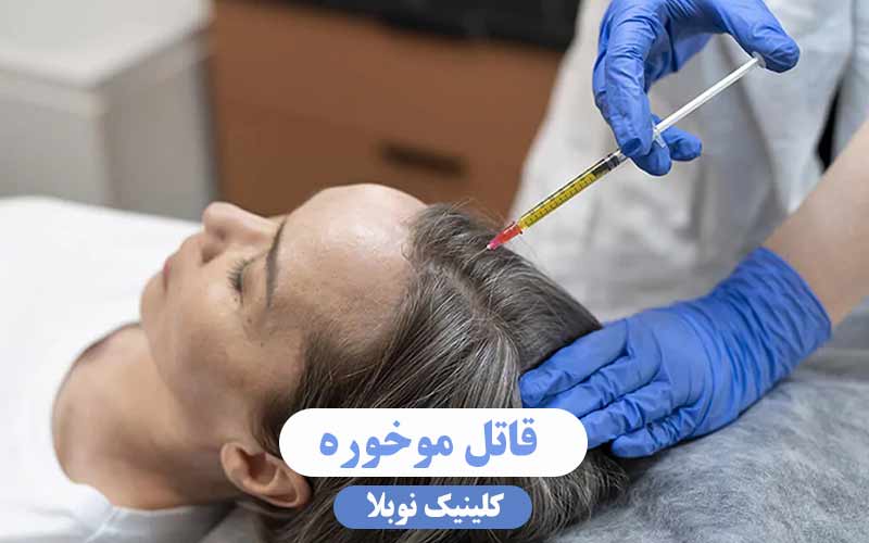 قاتل موخوره را بشناسید ؛ چرا پی آر پی مو بهترین روش درمانی است؟
